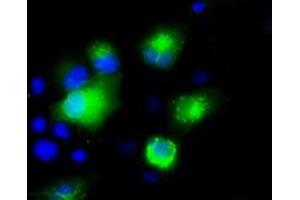 Image no. 3 for anti-Premelanosome Protein (PMEL) antibody (ABIN2725801)