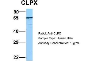 Image no. 1 for anti-ClpX Caseinolytic Peptidase X (CLPX) (C-Term) antibody (ABIN2789497)