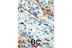 Image no. 2 for anti-NUAK Family, SNF1-Like Kinase, 1 (NUAK1) (AA 604-634), (C-Term) antibody (ABIN392640)