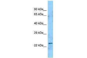 anti-ADP-Ribosyltransferase 5 (ART5) (N-Term) antibody