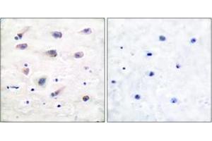Immunohistochemistry analysis of paraffin-embedded human brain, using PLCB3 (Phospho-Ser1105) Antibody.