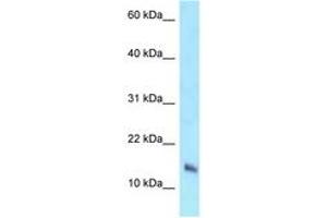Image no. 1 for anti-NADH Dehydrogenase (Ubiquinone) 1 beta Subcomplex, 7, 18kDa (NDUFB7) (AA 23-72) antibody (ABIN6747893)
