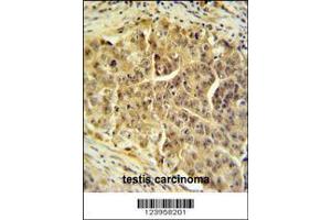 Image no. 2 for anti-Cell Division Cycle 45 Homolog (S. Cerevisiae) (CDC45) (AA 236-263) antibody (ABIN653837)