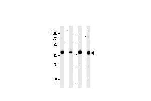 Image no. 2 for anti-Aldolase (ALD) (AA 66-95), (N-Term) antibody (ABIN5530350)