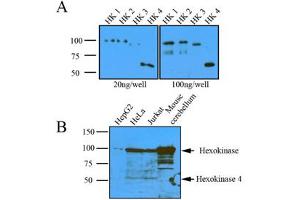 Image no. 4 for anti-Hexokinase 1 (HK1) (AA 1-917), (N-Term) antibody (ABIN317095)