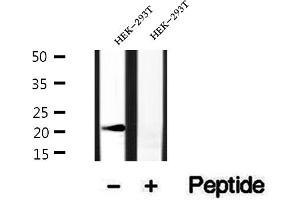 Image no. 2 for anti-ADP Ribosylation Factor Like GTPase 6 (ARL6) (Internal Region) antibody (ABIN6260210)