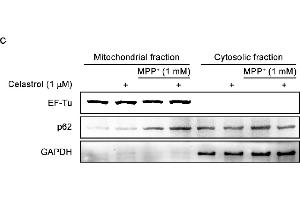 Image no. 23 for anti-Sequestosome 1 (SQSTM1) (Internal Region) antibody (ABIN2854836)