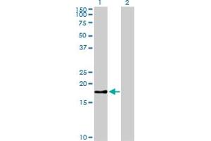 anti-Baculoviral IAP Repeat-Containing 5 (BIRC5) (AA 1-100) antibody
