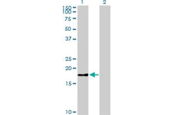 anti-Baculoviral IAP Repeat-Containing 5 (BIRC5) (AA 1-100) antibody
