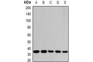 Image no. 1 for anti-THO Complex 1 (THOC1) (full length) antibody (ABIN6005756)