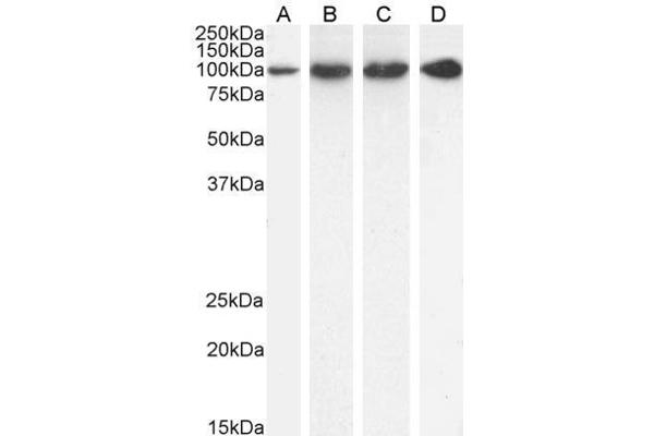 anti-Proteasome (Prosome, Macropain) 26S Subunit, Non-ATPase, 2 (PSMD2) (C-Term) antibody