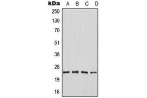 Image no. 1 for anti-SERTA Domain Containing 1 (SERTAD1) (Center) antibody (ABIN2707016)