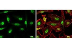 ICC/IF Image FOXO3A antibody [C3], C-term detects FOXO3A protein at nucleus by immunofluorescent analysis.