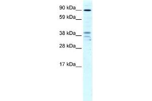 Image no. 1 for anti-Zinc Finger CCCH-Type Containing 7B (ZC3H7B) (N-Term) antibody (ABIN1109547)