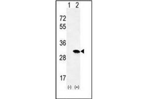 Image no. 1 for anti-HRas proto-oncogene, GTPase (HRAS) (AA 153-184), (C-Term) antibody (ABIN952792)