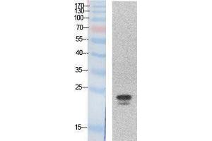Image no. 1 for anti-Sex Determining Region Y (SRY) (Internal Region) antibody (ABIN3181048)