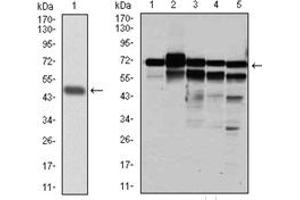 Image no. 4 for anti-Replication Protein A1, 70kDa (RPA1) antibody (ABIN1108896)