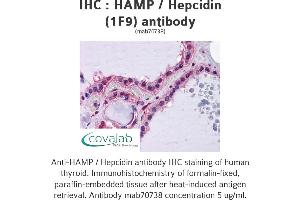 Image no. 1 for anti-Hepcidin Antimicrobial Peptide (HAMP) (AA 25-85), (full length) antibody (ABIN1723595)