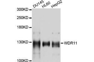 Image no. 1 for anti-WD Repeat Domain 11 (WDR11) antibody (ABIN6566998)