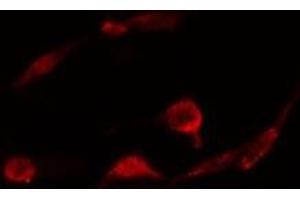 Image no. 2 for anti-phospholipase C, beta 3 (Phosphatidylinositol-Specific) (PLCB3) antibody (ABIN6264282)