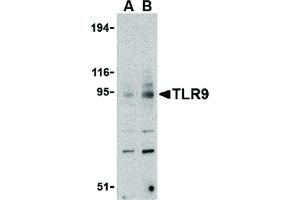 Western Blot of TLR9 Antibody - Western Blot of TLR9 antibody in mouse spleen cell lysate.