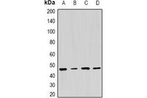 Image no. 3 for anti-Proteasome (Prosome, Macropain) 26S Subunit, ATPase, 5 (PSMC5) antibody (ABIN2966950)