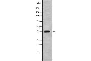 Image no. 1 for anti-Cathepsin S (CTSS) (Internal Region) antibody (ABIN6261104)