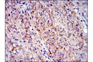 Image no. 1 for anti-Mast/stem Cell Growth Factor Receptor (KIT) antibody (ABIN969237)