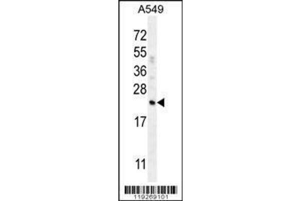 anti-Complement Factor D (CFD) (AA 68-99), (N-Term) antibody