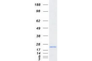 Image no. 1 for Methionine Sulfoxide Reductase B3 (MSRB3) (Transcript Variant 1) protein (Myc-DYKDDDDK Tag) (ABIN2726474)