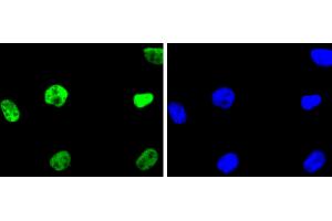 Image no. 3 for anti-Histone Deacetylase 2 (HDAC2) antibody (ABIN5557480)