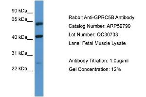 Image no. 2 for anti-G Protein-Coupled Receptor, Family C, Group 5, Member B (GPRC5B) (N-Term) antibody (ABIN2788217)