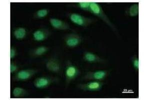 Image no. 2 for anti-Inhibitor of DNA Binding 1, Dominant Negative Helix-Loop-Helix Protein (ID1) antibody (ABIN931172)