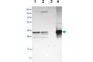 Image no. 1 for anti-Thiosulfate Sulfurtransferase (Rhodanese) (TST) antibody (ABIN5590320)