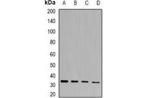 Image no. 2 for anti-Phytanoyl-CoA Dioxygenase Domain Containing 1 (PHYHD1) antibody (ABIN2966905)