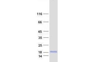 Image no. 1 for Presenilin Enhancer 2 Homolog (PSENEN) protein (Myc-DYKDDDDK Tag) (ABIN2728653)