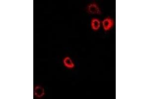 Image no. 1 for anti-6-Pyruvoyltetrahydropterin Synthase (PTS) antibody (ABIN2966960)