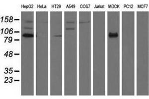 Western blot analysis of extracts (35 µg) from 9 different cell lines by using anti-ALDH1L1 monoclonal antibody.