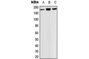 Image no. 1 for anti-PH Domain and Leucine Rich Repeat Protein Phosphatase 1 (PHLPP1) (C-Term) antibody (ABIN2705120)