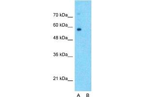 Image no. 6 for anti-Solute Carrier Family 6 (Neurotransmitter Transporter, Noradrenalin), Member 2 (SLC6A2) (Middle Region) antibody (ABIN2777051)