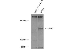 Western Blotting (WB) image for anti-Calcyphosine 2 (CAPS2) (AA 15-89) antibody (ABIN1742521)