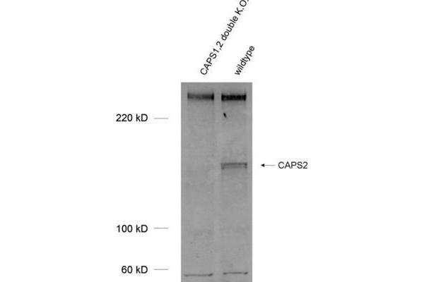 Calcyphosine 2 antibody  (AA 15-89)