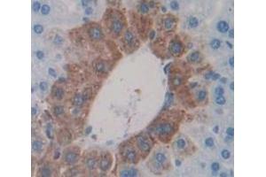 Image no. 2 for anti-Microseminoprotein, beta (MSMB) (AA 21-113) antibody (ABIN1862941)