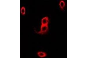 Image no. 2 for anti-Neutrophil Cytosolic Factor 2 (NCF2) antibody (ABIN2966870)