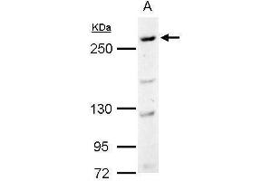 WB Image CAD antibody [C2C3], C-term detects CAD protein by Western blot analysis.