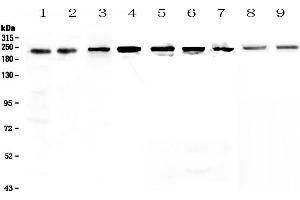 Image no. 4 for anti-SWI/SNF Related, Matrix Associated, Actin Dependent Regulator of Chromatin, Subfamily A, Member 4 (SMARCA4) (AA 555-763) antibody (ABIN5692863)
