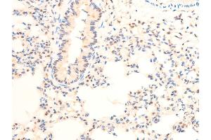 Image no. 5 for anti-Jun Proto-Oncogene (JUN) (pThr239) antibody (ABIN6255640)