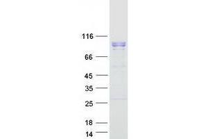 Image no. 1 for WD Repeat Domain 36 (WDR36) protein (Myc-DYKDDDDK Tag) (ABIN2735510)