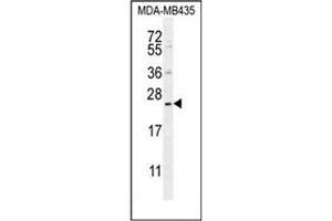 Image no. 2 for anti-Family with Sequence Similarity 109, Member A (FAM109A) (AA 10-39), (N-Term) antibody (ABIN952171)