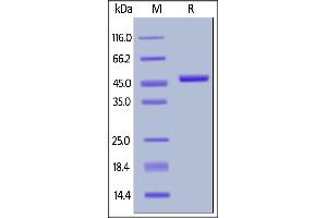 SDS-PAGE (SDS) image for Interleukin 2 (IL2) (AA 21-153) (Active) protein (Fc Tag,AVI tag,Biotin) (ABIN6731255)